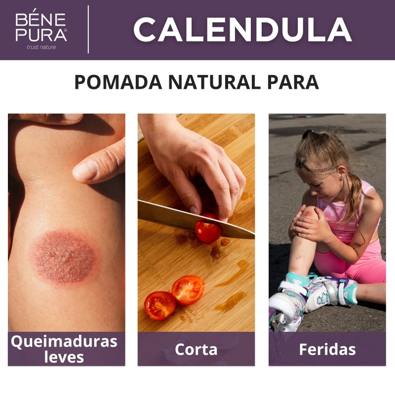 Conjunto Pomadas para Feridas, Queimaduras e Comichao 2