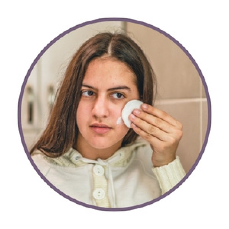 Cremes anti-acne