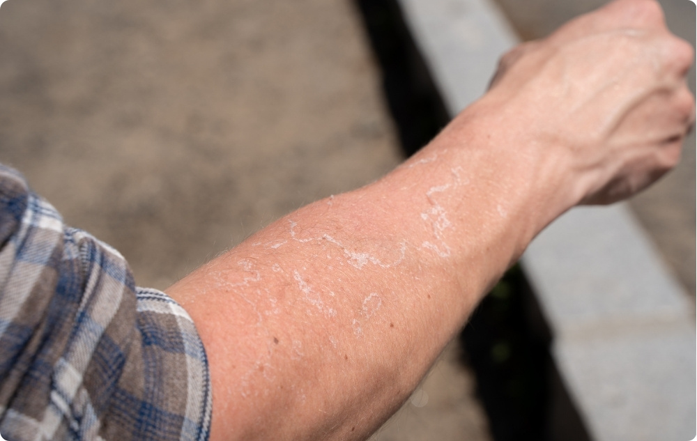 Como óleo para pele irritada e seca