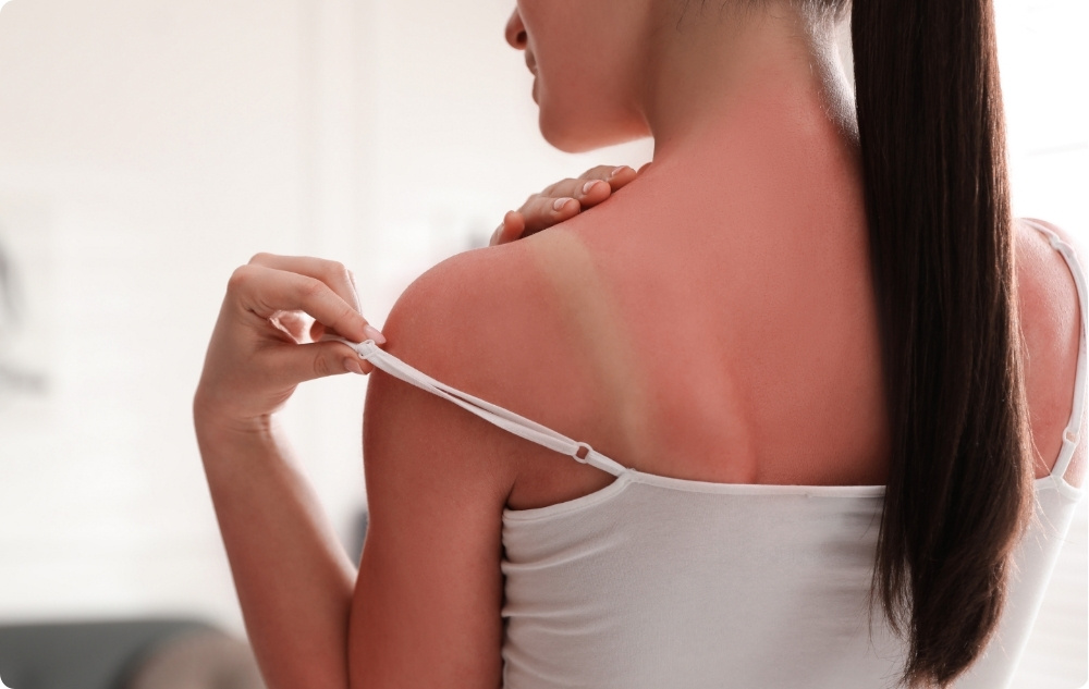 Como uma loção pós-solar calmante