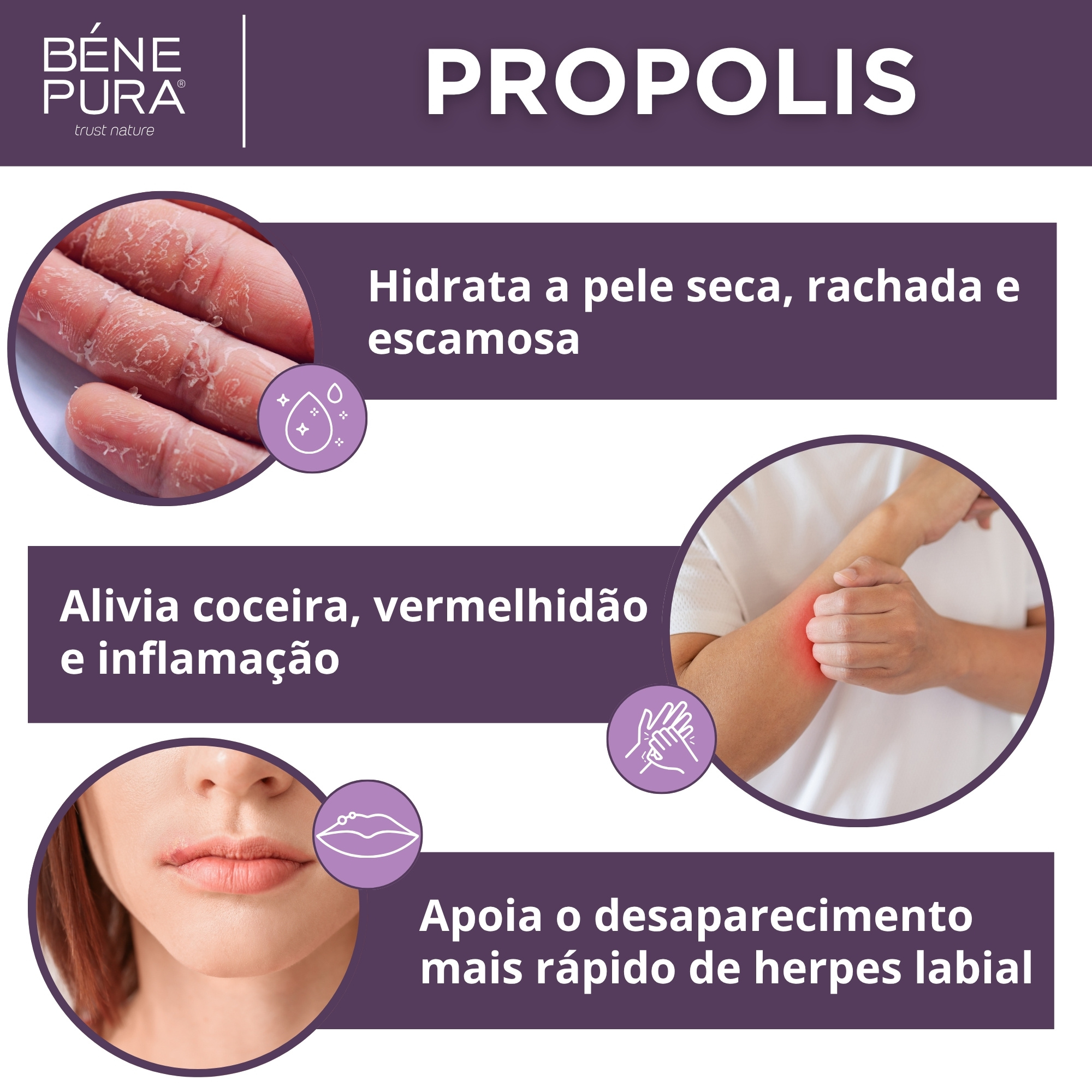 Conjunto "Pomadas para Comichao"