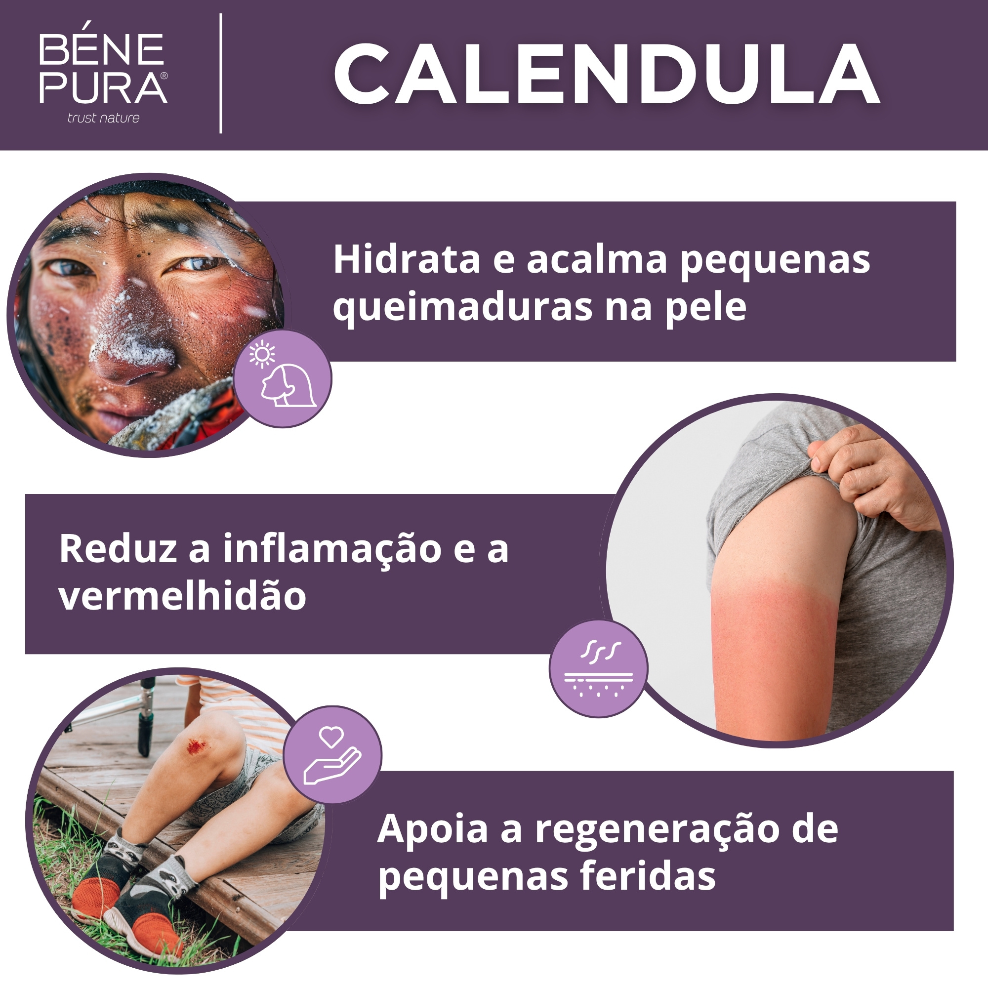 Conjunto "Pomadas para Feridas, Queimaduras e Comichao 2"